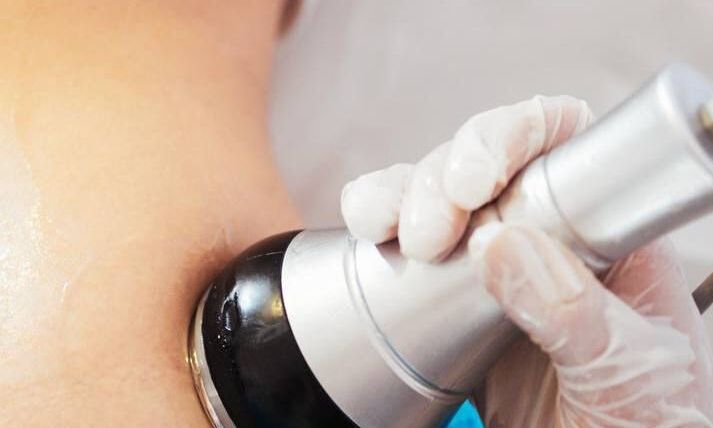 Med. zertifiziertes System gegen Cellulite und sportresistente Fettdepots. Kavitation mit Vakuum Radiofrequenz