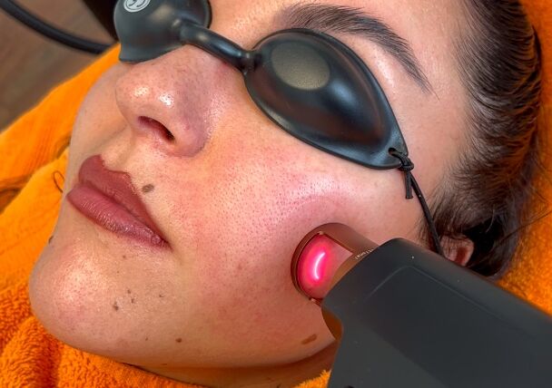 „Lavandula“ Thulium Laser. Die neuste kosmetisch-medizinische Innovation