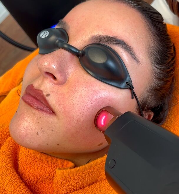 „Lavandula“ Thulium Laser. Die neuste kosmetisch-medizinische Innovation